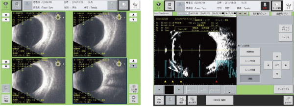 超音波計測・診断システム UD-8000AB イメージ