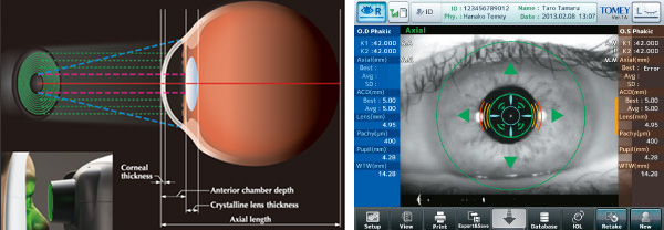 光学式眼軸長測定装置 OA-2000 イメージ