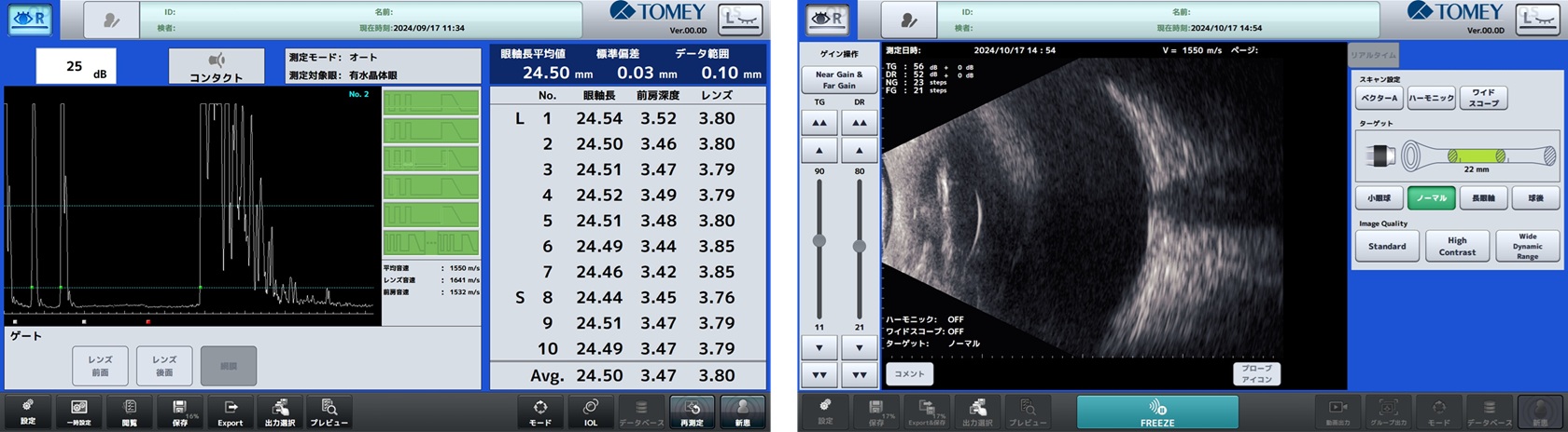 超音波計測・診断システム UD-9000 イメージ